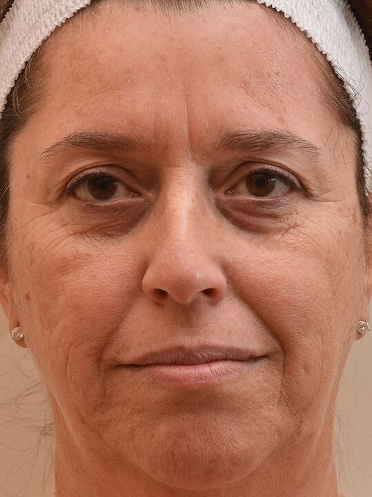 Pa sam pogledao prije nego što sam koristio Eudalie kremu