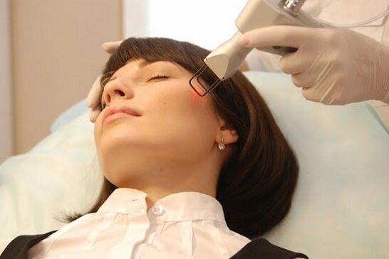 Ultrazvučni lifting